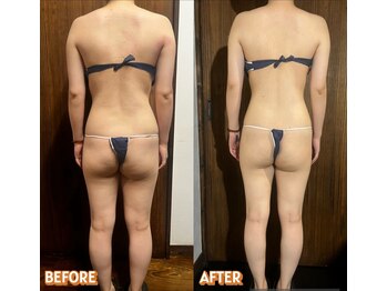 ビュップ 鶴ヶ峰店(美up)/筋膜リリース120分コース