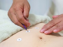 すぎもと鍼灸院