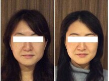 美容整体 ウェリナ 蟹江院/小顔矯正/骨盤矯正/美脚サロン 