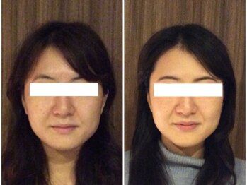 美容整体 ウェリナ 蟹江院/小顔矯正/骨盤矯正/美脚サロン