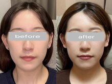 ナビレラ(navillera)の雰囲気（小顔矯正とアイブロウのセットも！印象を整えます◎）