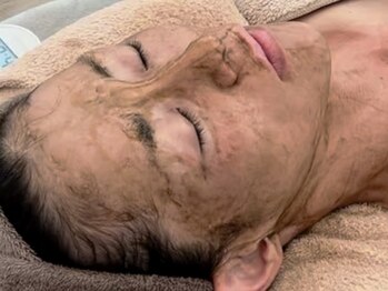 シュリー(Sriii)/ハーブピーリング