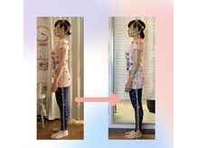 整体院 ツイてる(椎照)の雰囲気（顎下のたるみケアは骨格矯正で改善◎）