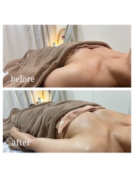 サロンエム(salon em)の写真/1度でこの変化！看護師&理学療法士考案のケア【ボンボンバスト】痛く無いオールハンドのバストケアを♪