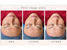 プチ ビサージュ ポワール(Petit Visage Poire)の雰囲気（小顔コルギ・施術効果）