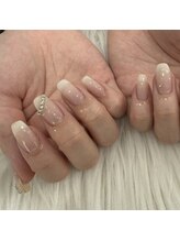 ビネイル(BINAIL)/