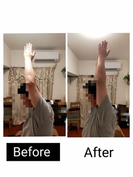 アース エンジェル整体院/ビフォアフ　肩こり　ストレッチ