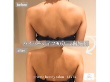 ココラーレ(cocorare)の雰囲気（とにかく変化が凄い！他サロンとの圧倒的な違いをご実感下さい♪）