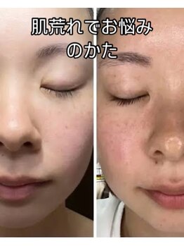 ウェルビーイング(well-being)/大泉学園 肌質改善