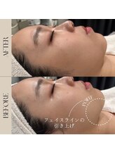 インフィニーズ(INFINEEZ)/カスタマイズ120分小顔矯正20代