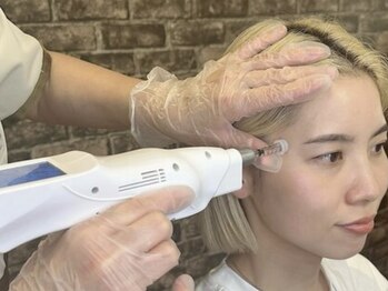 ボリスビアン プリンシェ(Borisvian Prinche)の写真/【新メニュー☆エクソソーム】美容成分を密に均一に皮膚へ届けることで様々な肌悩み改善が期待できます♪