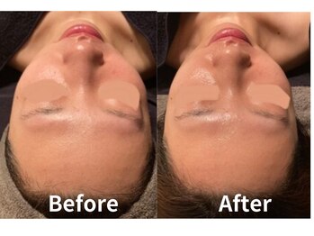 サロン デ ミロ(Salon de Miro)/BeforeAfter多数！ブログへGO♪