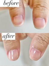 ニコワイズネイル(Nico Y's Nail)/【自爪育成コース】
