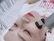サロン ド エヌ(Salon de N)の写真/【効果重視ならエクソリフト★】本気で肌改善したい方必見!毛穴引き締め、お顔全体ハリのある美肌へ♪