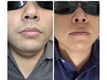 アプロディタの雰囲気（面倒なひげ剃りは卒業！彼氏や旦那さま、うちにお任せください♪）