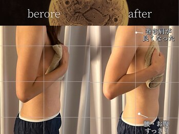 リムーン(REMOON.)/施術後の効果★