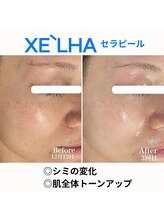 シュ シュ(chou chou)/【セラピール】