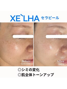 シュ シュ(chou chou)/【セラピール】