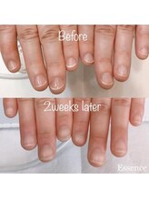 エッセンス (Essence)/2週間で変化実感｜補強＋育成