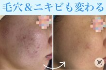 トータルビューティー ココ(Total Beauty CoCo)