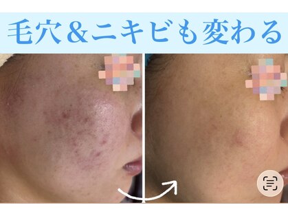 トータルビューティー ココ(Total Beauty CoCo)の写真
