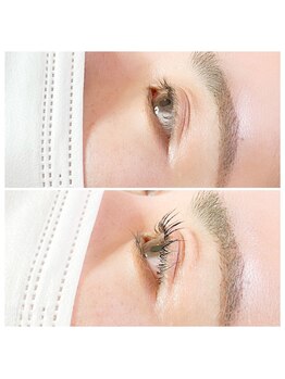 ヴィヴラン(viv-run)/ビフォーアフター