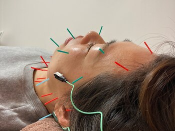 ばば鍼灸院/40代女性の方