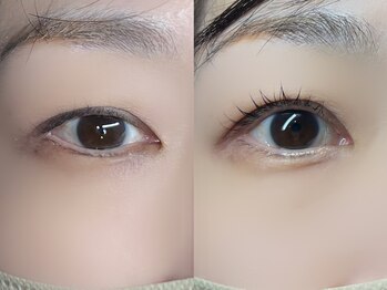 リジュール(Rejur)/印象が変わる！