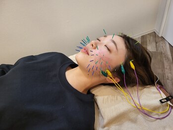 アラキ(ARAKI)/緑橋で結果を追求した美容鍼