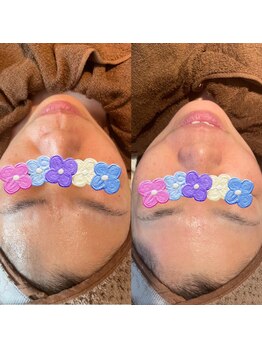 オーノ(Ohno)/マツヤニのB＆A