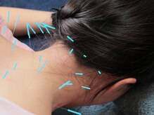 鍼灸施術用のお着替えをご用意◎リラックスして受けられる施術☆