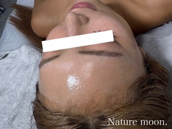ナチュールムーン(Nature moon.)/ハーブピーリング after