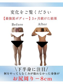 トゥジュール バイ ボウケンフライ(toujours by Bokenfly)/【むくみ】【痩身】【肩こり】