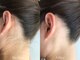 スマイルビューティラボ 別府店(Smile Beauty lab.)の写真