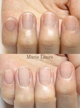 マリーロール 梅田店(Marie Laure)/自爪育成/深爪矯正/ネイルケア