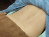 【自律神経を整えたい方におすすめ♪】全身の鍼灸　70分　¥6000