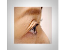 エムドット(M.)/カーリー♪