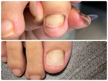 ヌーネイル(N.U nail)の雰囲気（フットケア＝健康寿命！トラブルネイルもお任せください♪）