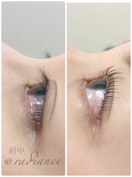 ラディアンス/Lカール