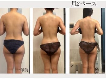 オーシャンブルーム 目黒(OceanBloom)/月2ペース３ヶ月ブライダル