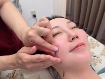 鍼灸整骨院ナガサキ(nagasaki)の写真/【美容鍼で肌が持つ力を呼び起こす】マッサージでは届かない皮膚の下にある真皮層を美容鍼で直接刺激◎