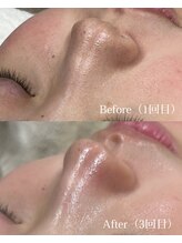 メイス 福井店(MEIS)/お客様Before、After