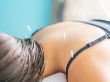 スクエアワン(SQUARE ONE)/