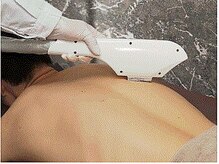 シンバ 南草津店(SIMBA)/【背中脱毛】