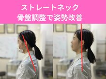 鍼灸整骨院やわら/