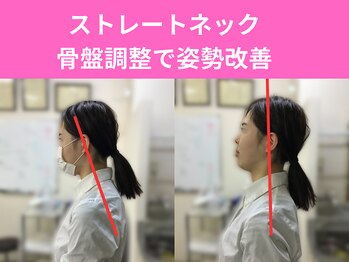 鍼灸整骨院やわら/