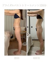 ハリムーン 仙台(harimoon)/バスト・ブライダル