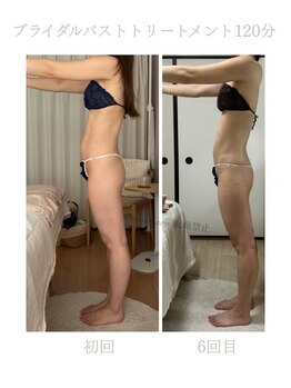 ハリムーン 仙台(harimoon)/バスト・ブライダル