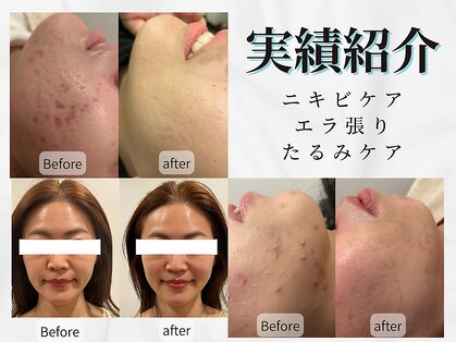 ビープラス(BEE PLUS)の写真