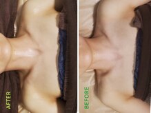 マニル アンド ネトラ(manil & netola)/デコルテ美容&首コリコース♪